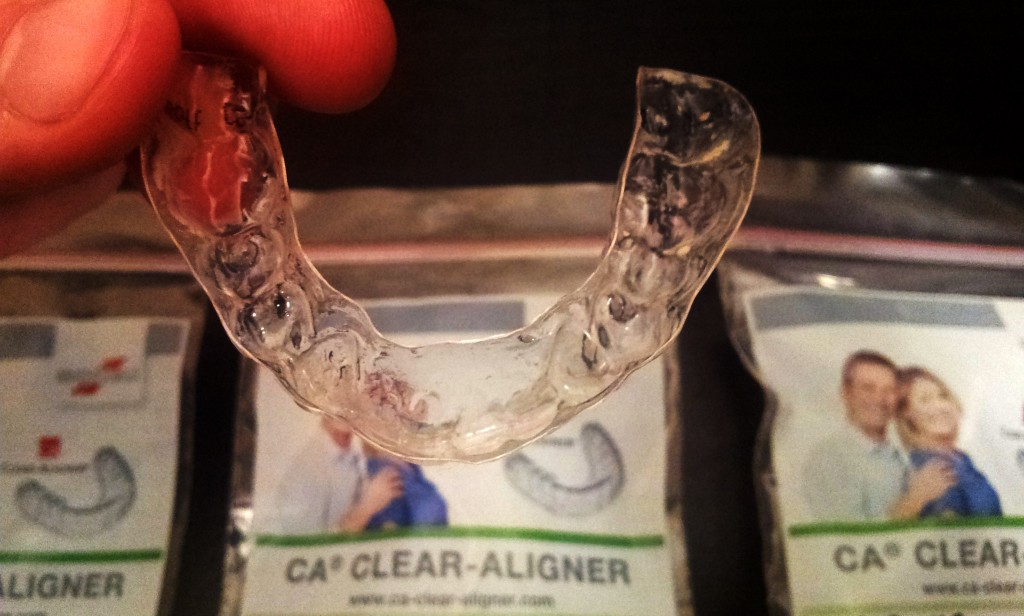 clear aligner dół