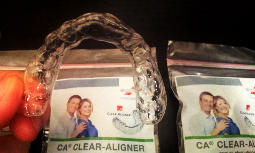 ckear aligner dół